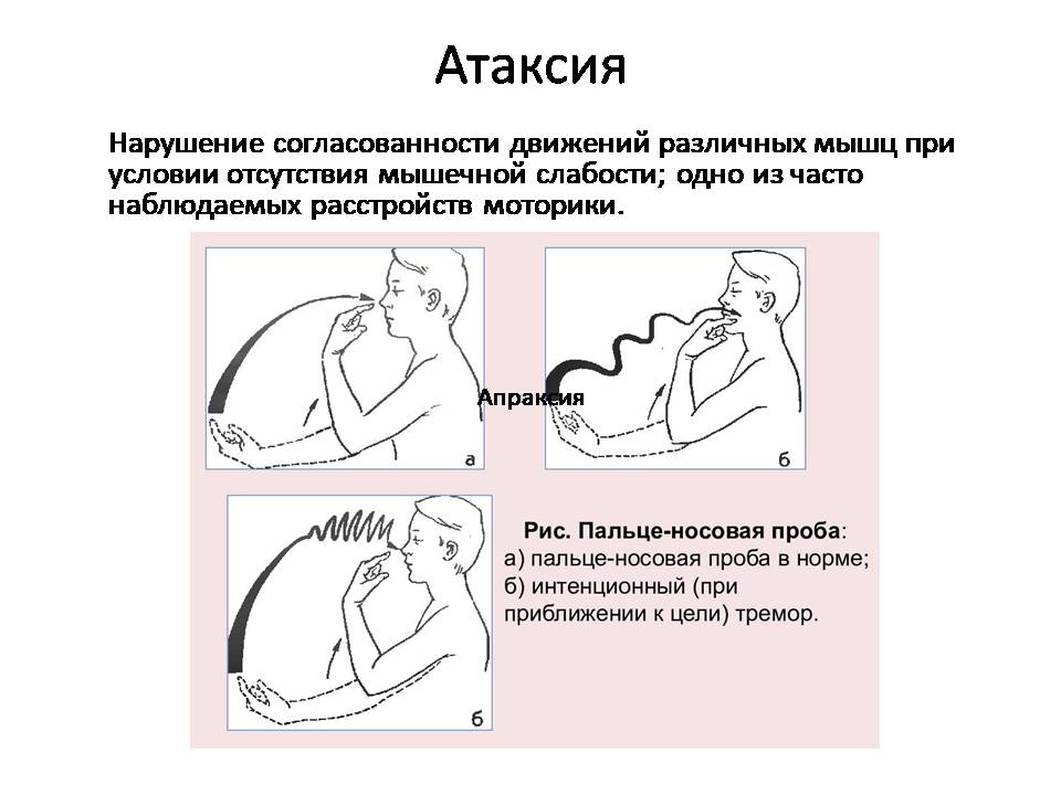 Наталья Панкина "Реабилитация после инсульта"